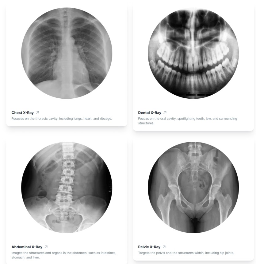 X-ray 결과를 판독하는 AI